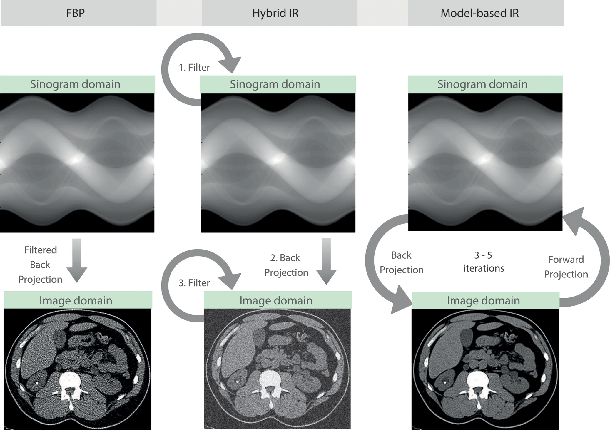 Overview of FBP, Hybrid IR, MBIR