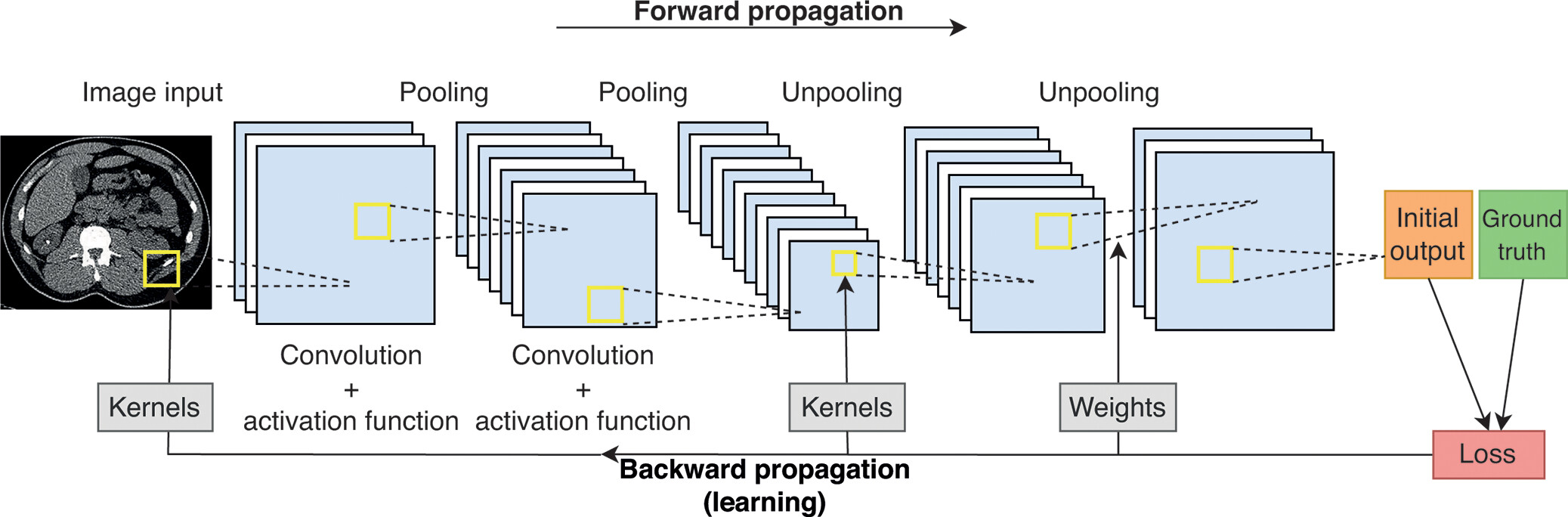 Overview of sinogram-based and image-based DLR frameworks