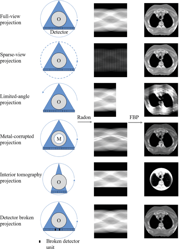 Causes of Incomplete Projection Data